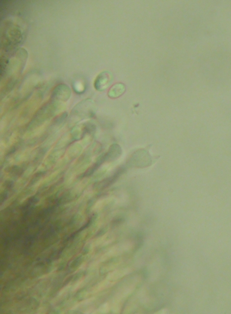 da determinare (Hyphodermella corrugata)